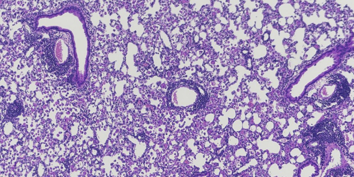 SciImmunology's tweet photo. Scientists revealed in 2021 that inhalation of the molecule IFNβ switched inflammatory dendritic cells into those that induce tolerance and are anti-inflammatory, helping alleviate #asthma in mice: https://t.co/ONzhL8hplo @UFMedicine @UFSurgery #WeekendReads https://t.co/7mzez4H9le