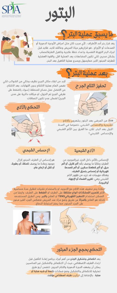 SPTA-Riyadh | سبتا الرياض tweet media