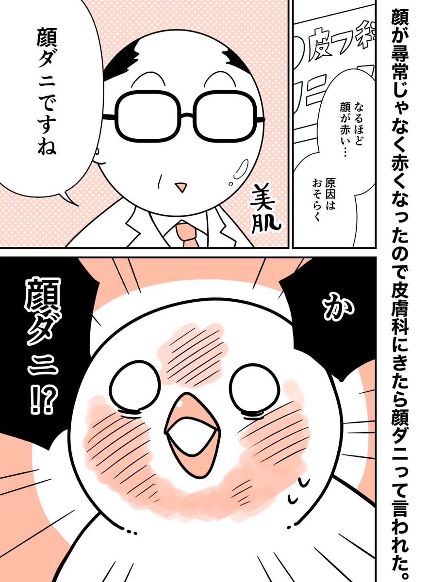 顔が尋常じゃなく赤くなったと思ったら？顔面でダニがパーリィしていた！