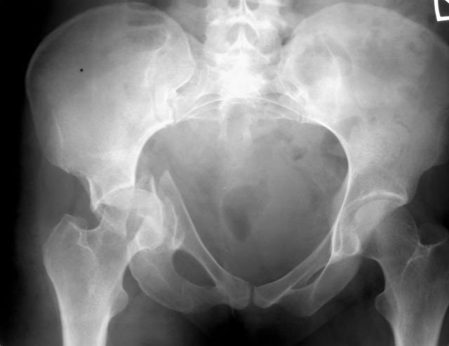 Normal or abnormal?  Diagnosis?