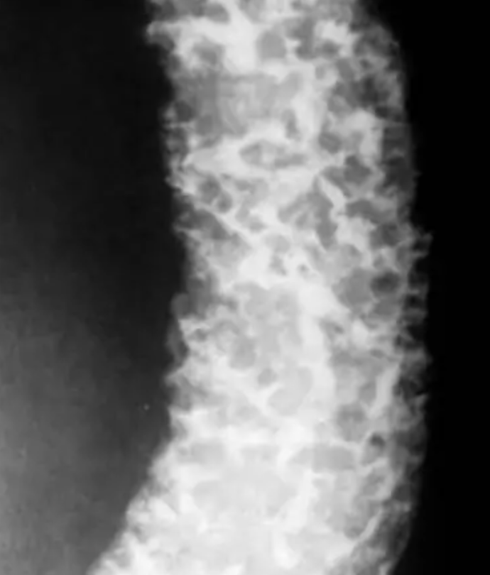 radRounds Radiology Network tweet media