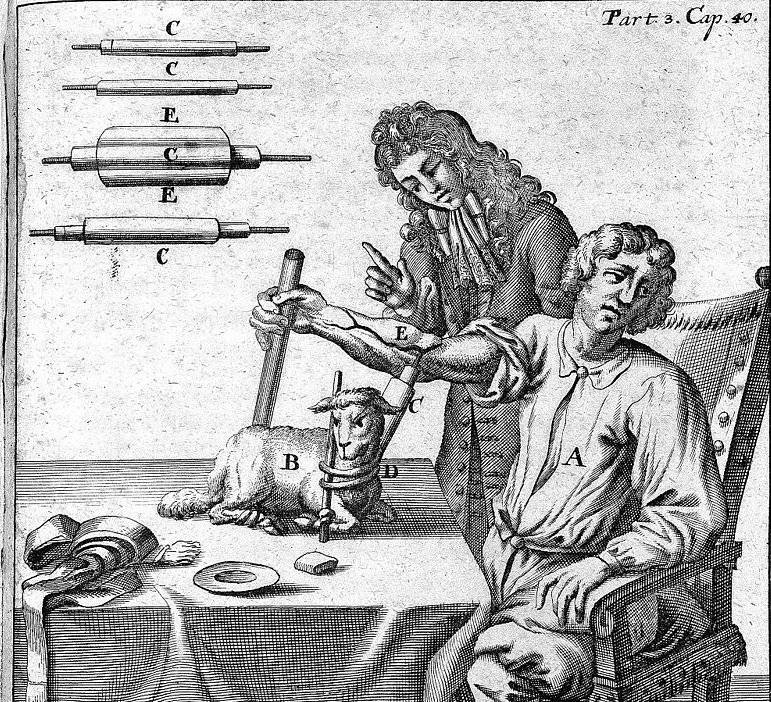#taldiacomavui, el 1667, el metge Jean-Baptiste Denys va administrar la 1ª transfusió d sang q està completament documentada. Va transferir unes 12 unces d sang d'ovella a un noi d 15 anys, q va sobreviure a la transfusió. Era el metge personal dl rei Lluís XIV