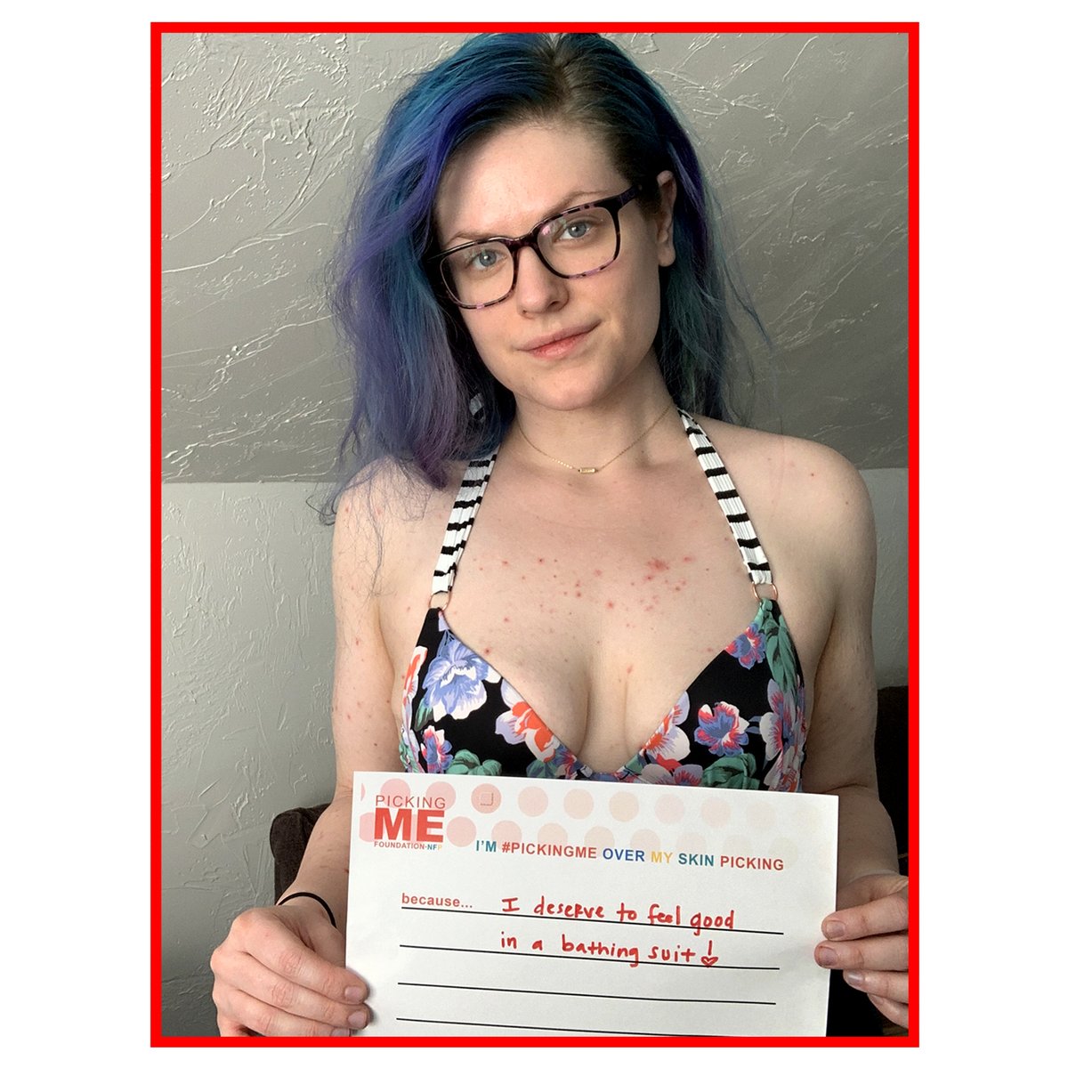 PickingMeFdn's tweet photo. Happy #NationalBallPointPenDay! Celebrate by printing & filling out a #PickingMePledge. This exercise is a great way to remember that you own your #Dermatillomania & that it doesn’t own YOU. Will you join us & put pen to paper for the #PickingMe Pledge? https://t.co/dxvM8v8DYy https://t.co/HIPLSBA0u0