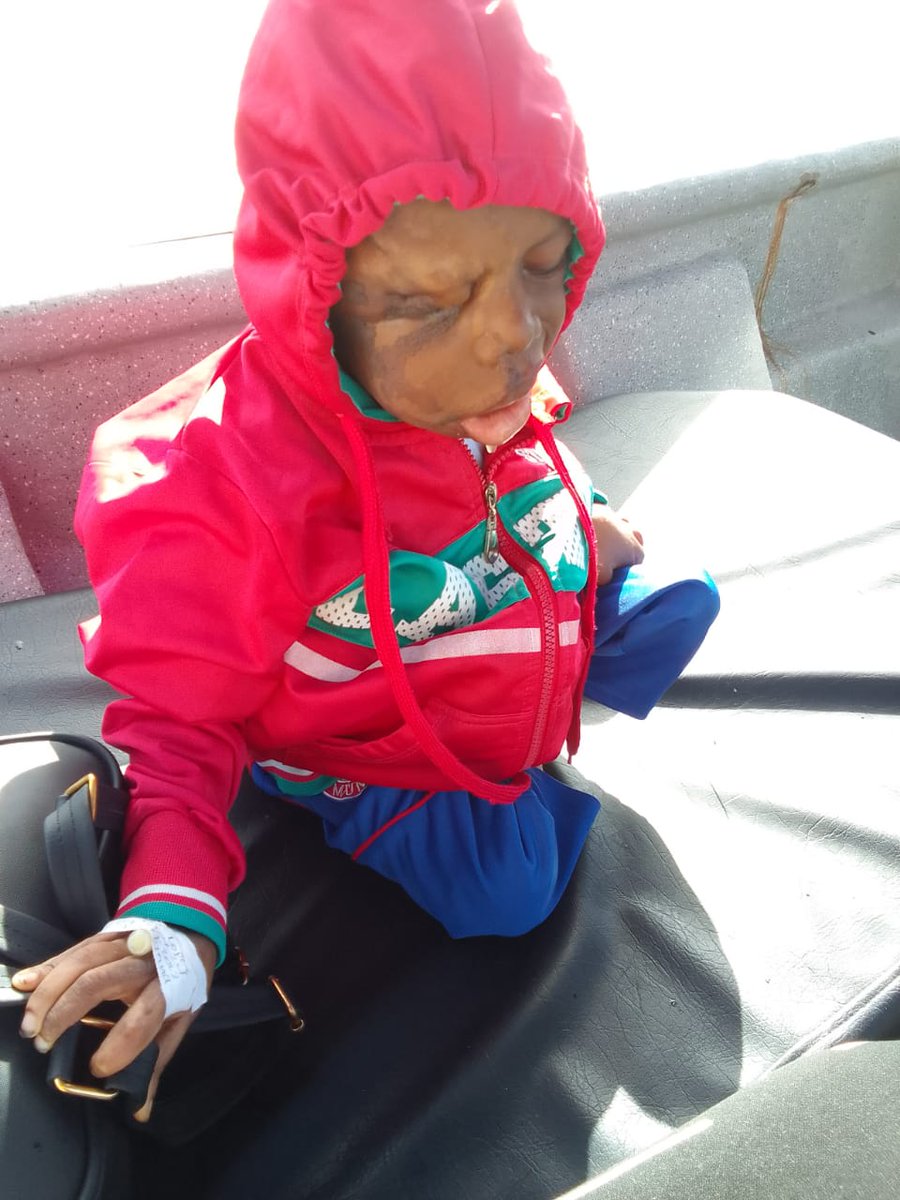 Haroldio2's tweet photo. Eps  @COMFACHOCO translado a esta señora con su hijo con Parálisis Cerebral por río luego carretera a Quibdó, cuando hay vuelos Pizarro Quibdo
@petrogustavo 
@LUISEROLAVE 
@FranciaMarquezM 
@GustavoBolivar 
@Uriasv 
@PoliciaColombia https://t.co/Kc9Bu1u9Mk