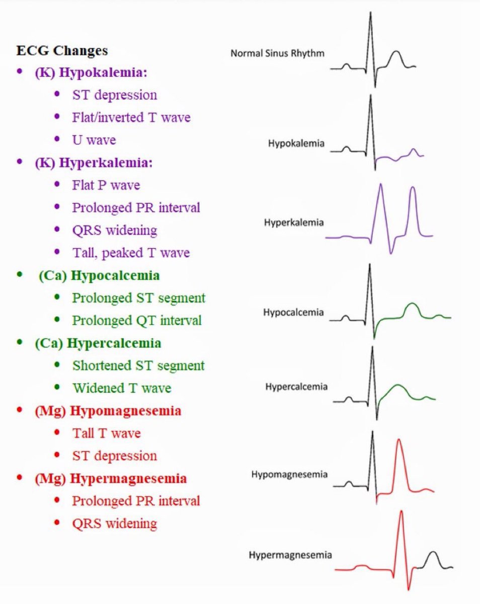 ECG changes