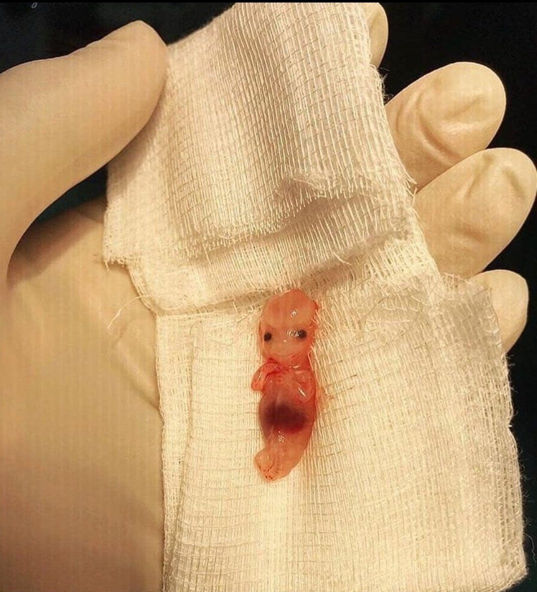 Dr. Ayush 𝕏 🧢 tweet media