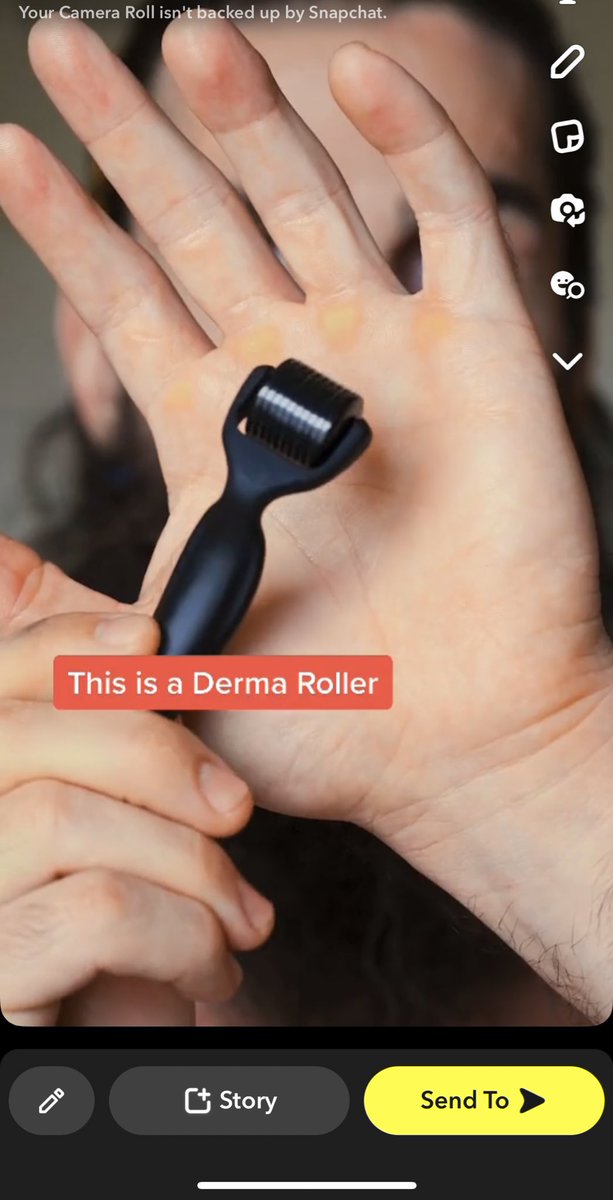 cedinnocent's tweet photo. my first real winning TikTok product. during beta phase of tiktok ads

sub <$1 CPA on 15,000+ orders 🤥

would have scaled this one to $100K/days easily…

until TikTok implemented policies against dermabrasion/micro-needling 🫠 https://t.co/RtPrmnl0Bk