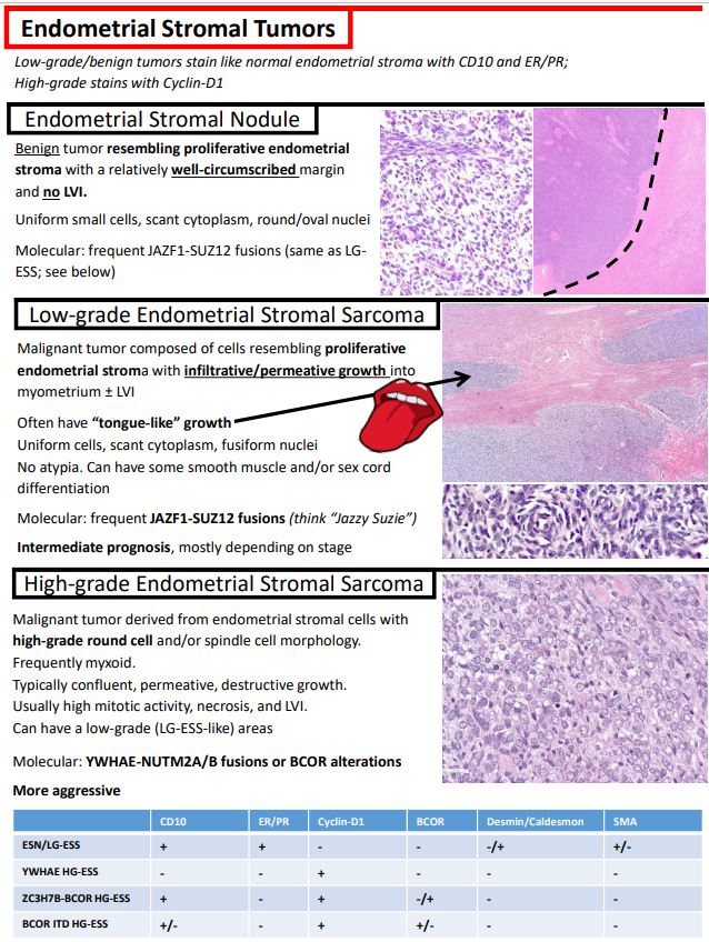 KurtSchaberg's tweet photo. I just updated my notes on Mesenchymal Tumors of the Uterus for my teaching website, "Kurt's Notes" (https://t.co/OKmaPvGQpJ).

🔬🔬🔬🔬🔬🔬🔬🔬🔬🔬🔬🔬🔬🔬🔬🔬🔬🔬🔬🔬🔬🔬🔬🔬🔬🔬🔬🔬🔬🔬🔬🔬

Full notes available here: https://t.co/8ygx5rSQs1 https://t.co/IrINYmVmKt