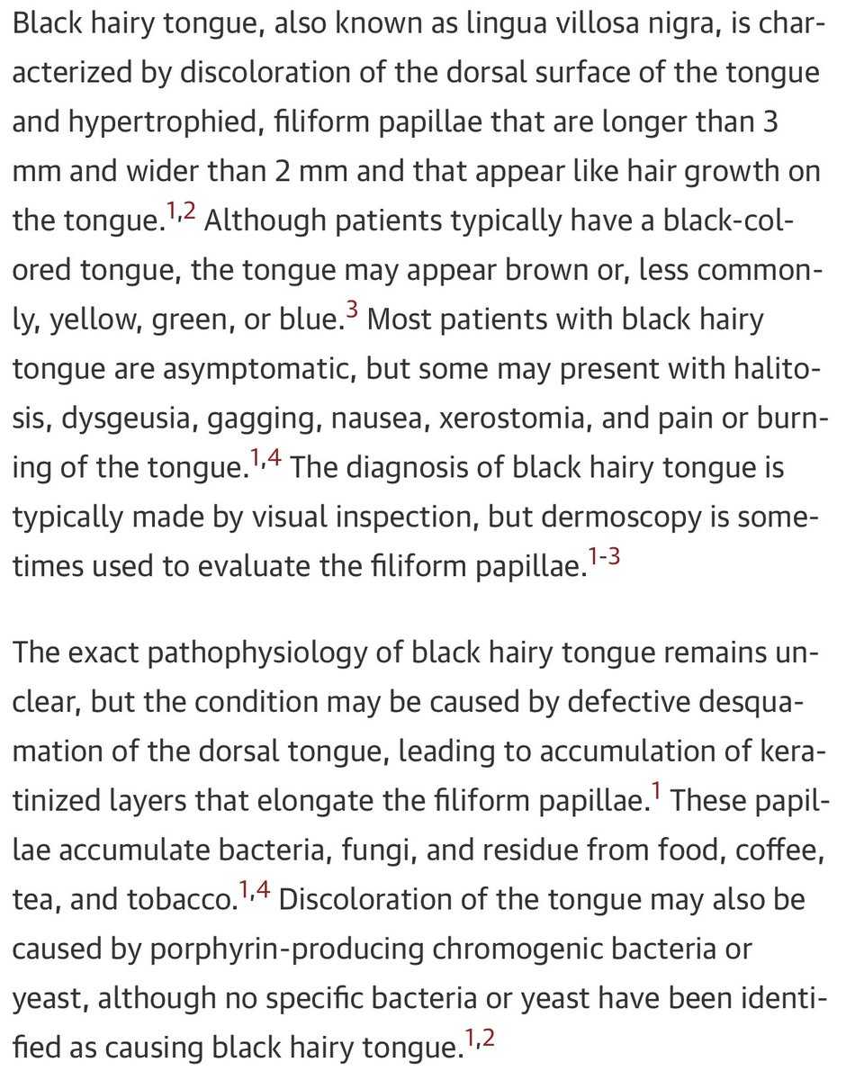 This was a black hairy tongue, a benign condition associated with tongue dysbiosis from antibiotics. The condition resolved within 2 weeks of brushing his tongue with a toothbrush without the need to change antibiotics 🪥 

jamanetwork.com/journals/jama/…