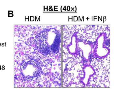 Phenomics_J's tweet photo. Alleviating #asthma with a touch of IFN-b! A promising starting point for #asthmapatient 
#phenomics
Read more in @SciImmunology
https://t.co/gthrqvex2m https://t.co/XzyJGl7u00