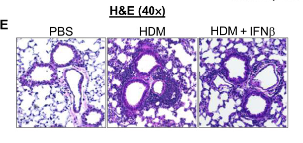 Phenomics_J's tweet photo. Alleviating #asthma with a touch of IFN-b! A promising starting point for #asthmapatient 
#phenomics
Read more in @SciImmunology
https://t.co/gthrqvex2m https://t.co/XzyJGl7u00
