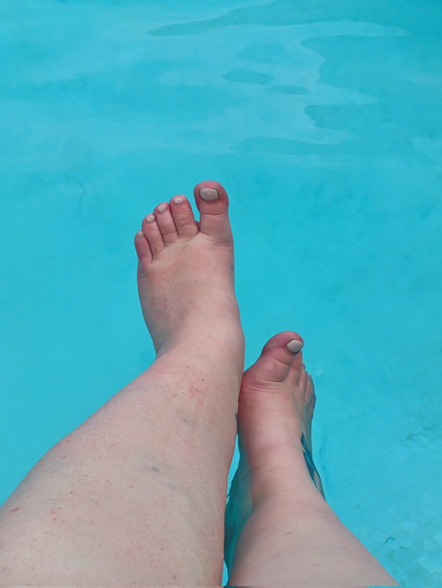 about_toes's tweet photo. Pool time 🌞 more content linked
#widefeet #flatfeet #chubbytime #pooltime #vacationmode #feet #feet_lover #feetfethish #feetcontent #feetpic #onlyfansgirl https://t.co/NYjKWeNhqz