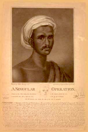 SanatanTalks's tweet image. Sushruta: father of plastic surgery!

In 1794, the third Mysore war took place between Tipu Sultan and the British.

Mysore soldiers captured a cart which was carrying food for the British army. The driver of this vehicle was a simple Marathi named Kosaji. Tipu Sultan ordered to…