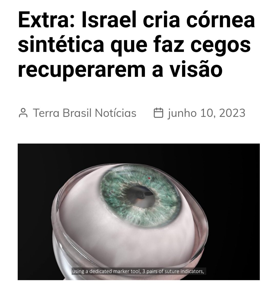 Que Deus abençoe esse projeto!!! Israel cria córnea sintética que faz cegos recuperarem a visão 🙏 terrabrasilnoticias.com/2023/06/extra-…