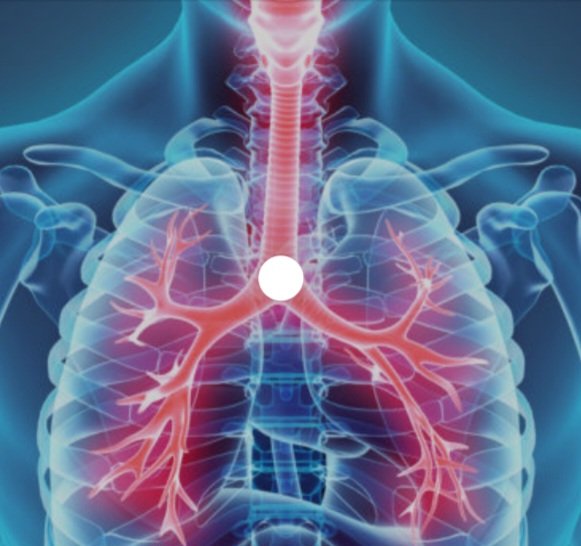 Que se passe t il ? 20 crises d'asthme dans la nuit aux urgences ? Et vous ? Même constat ?