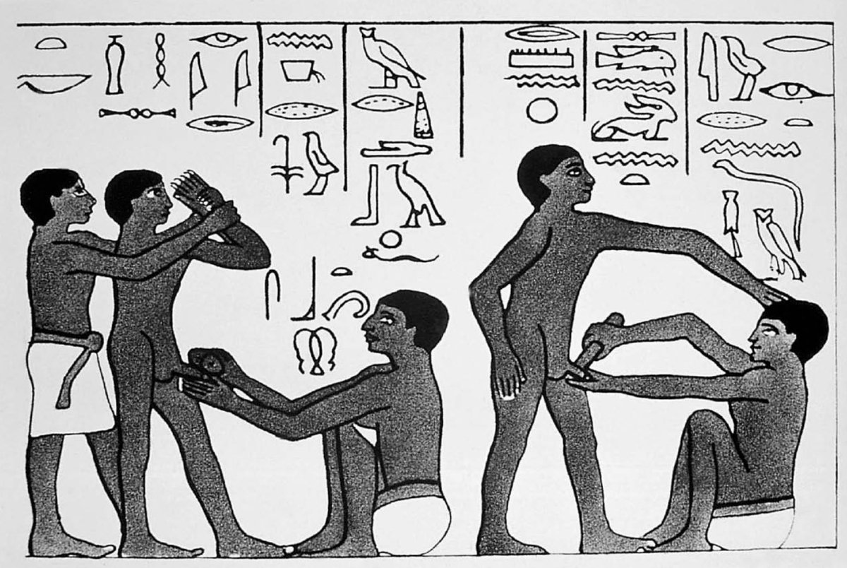 CIRCUMCISION -WORLD’S OLDEST ELECTIVE SURGERY! 

Circumcision is considered to be the most ancient ‘elective’ operation and was practiced in Ancient Egypt by assistants to the priests on the priests and on members of royal families.