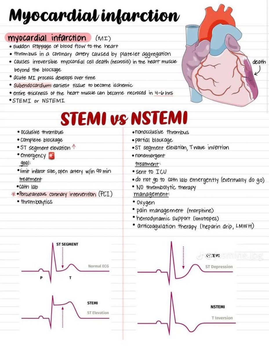 🫀Myocardial infarction

#stroke #MedTwitter #MedStudentTwitter #MedEd #anatomy #medicine #CardioTwitter #Cardiology #CardioEd #cardiovascular #ECG