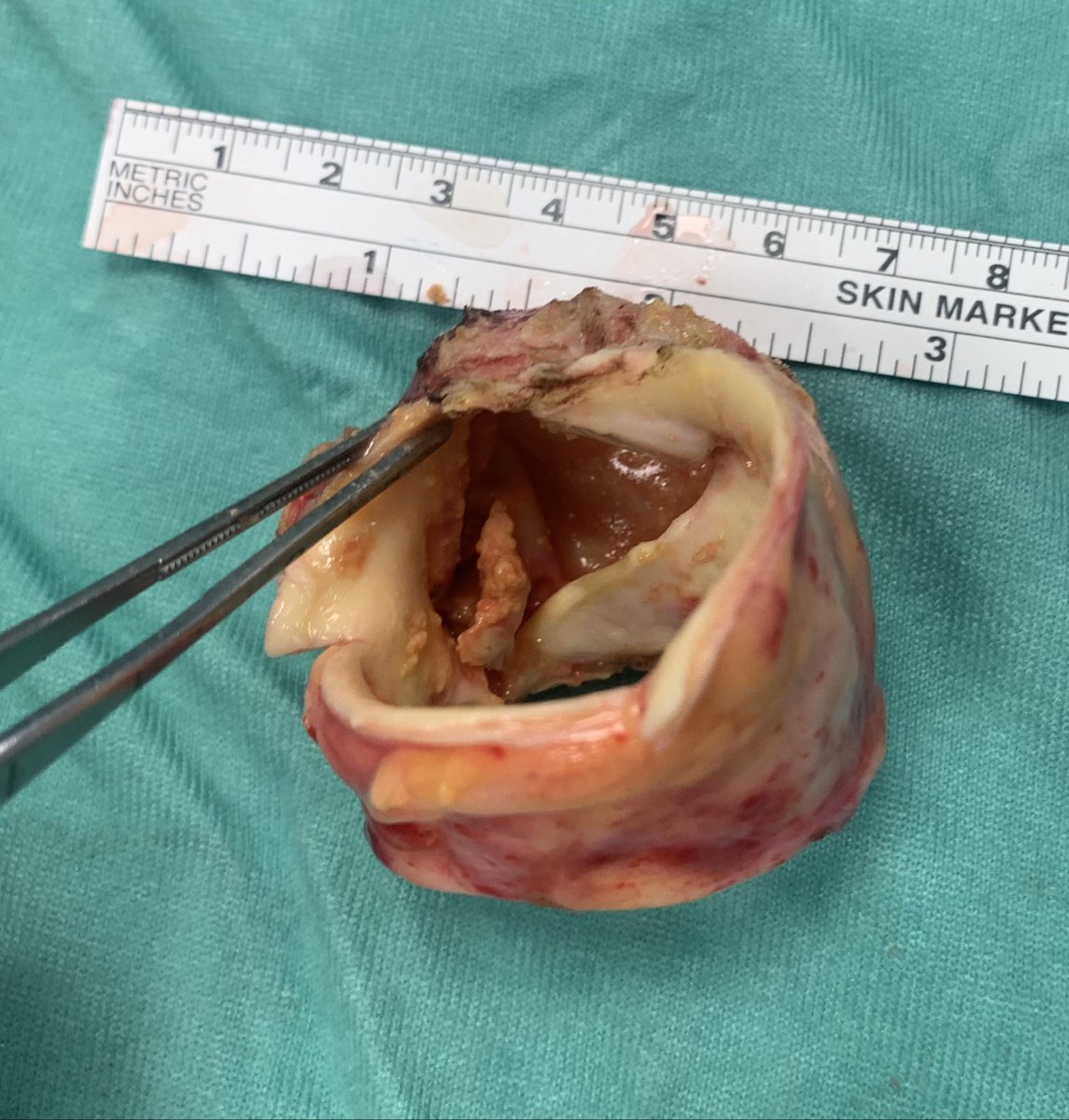 Dror Leviner tweet media