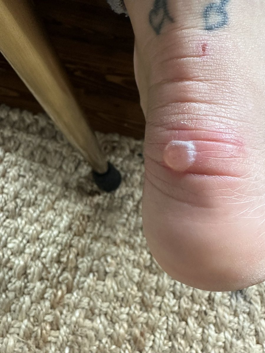 Aprilsunbeam's tweet photo. @hm_custserv these shoes were a complete waste of money, lovely shoes but sadly a pair I will never be able to wear again ! https://t.co/eyBTj1AYcv