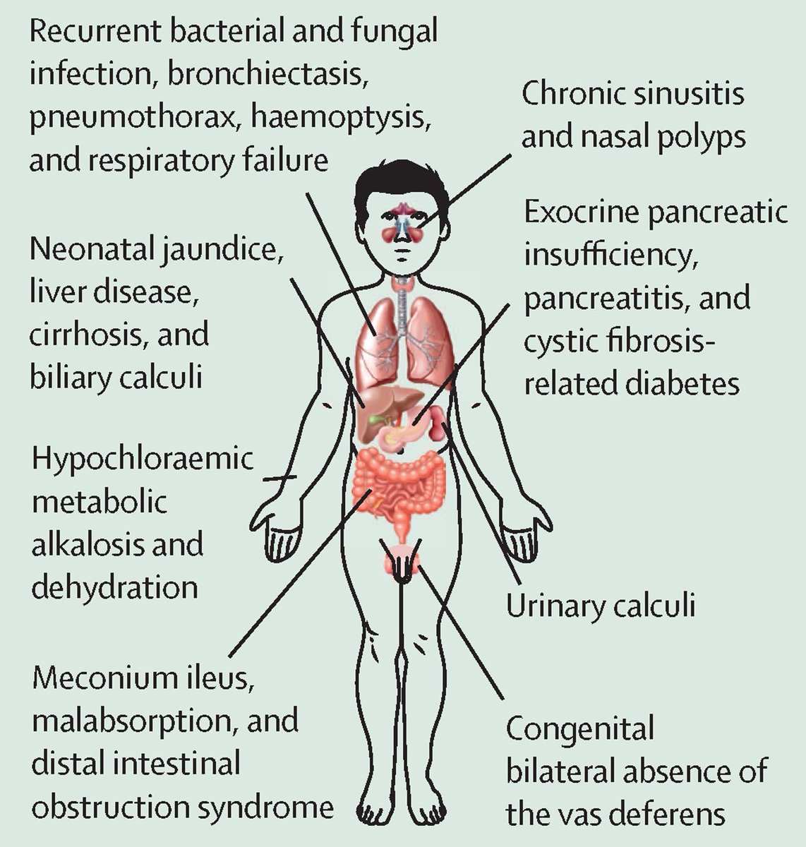keith-siau-on-twitter-what-is-the-condition-represented-in-this-diagram