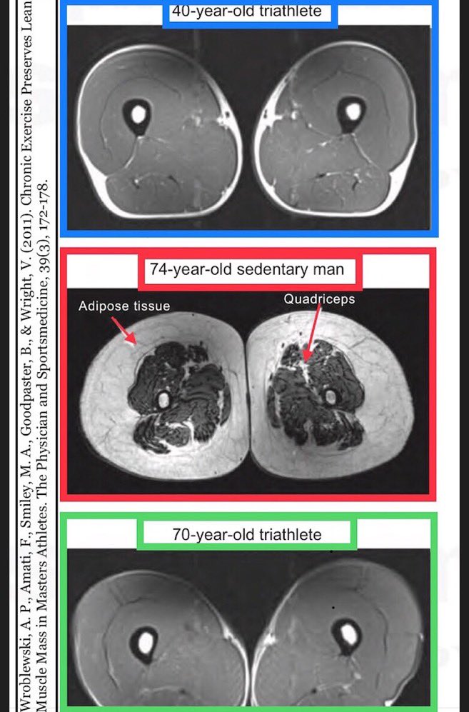 Sarcopenia is not age-related. It is disuse related (plus all the usual suspects that accelerate development).