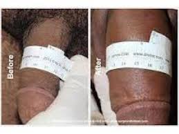 LiboChris's tweet image. @BazookaEnlargement Oil and cream the Only 100% Effective Remedy (NO SIDE EFFECT) To CONQUER Weak Erection, Small Manhood, And Premature Ejaculation Within 14 Days.