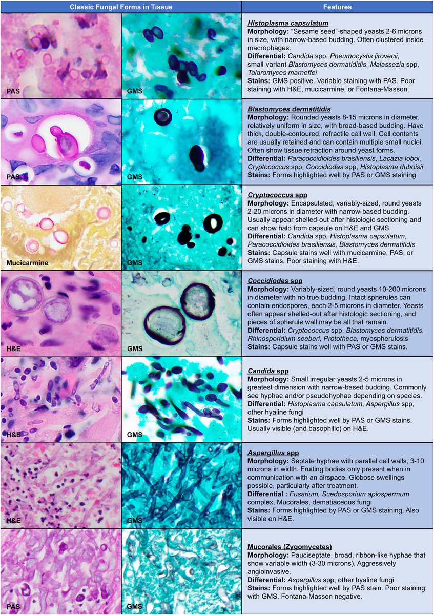 Nice summary of #EmergingFungalInfections by @dan_diekema and @mparsonsmd (link below), and superb fungal histopath figure: