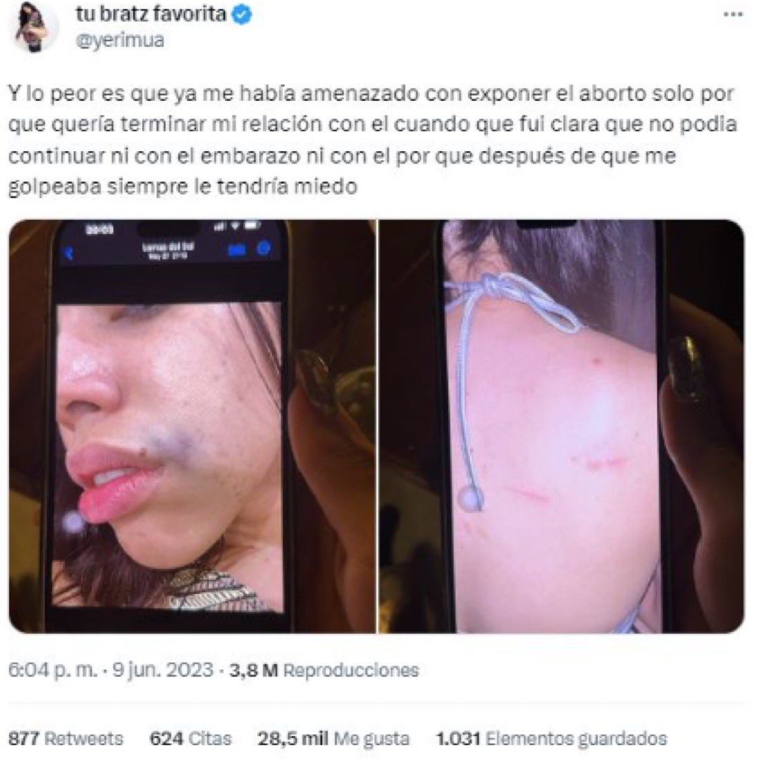 laraveidt's tweet photo. Naim Darrechi que admitió haberle roto el móvil a una de sus ex novias estampándolo y que la había empujado “como en todas las parejas” y posteriormente reconoció mentir para tener relaciones sin preservativo ha agredido a otra pareja recientemente cuando esta quiso dejarle https://t.co/GY6gYJZqol