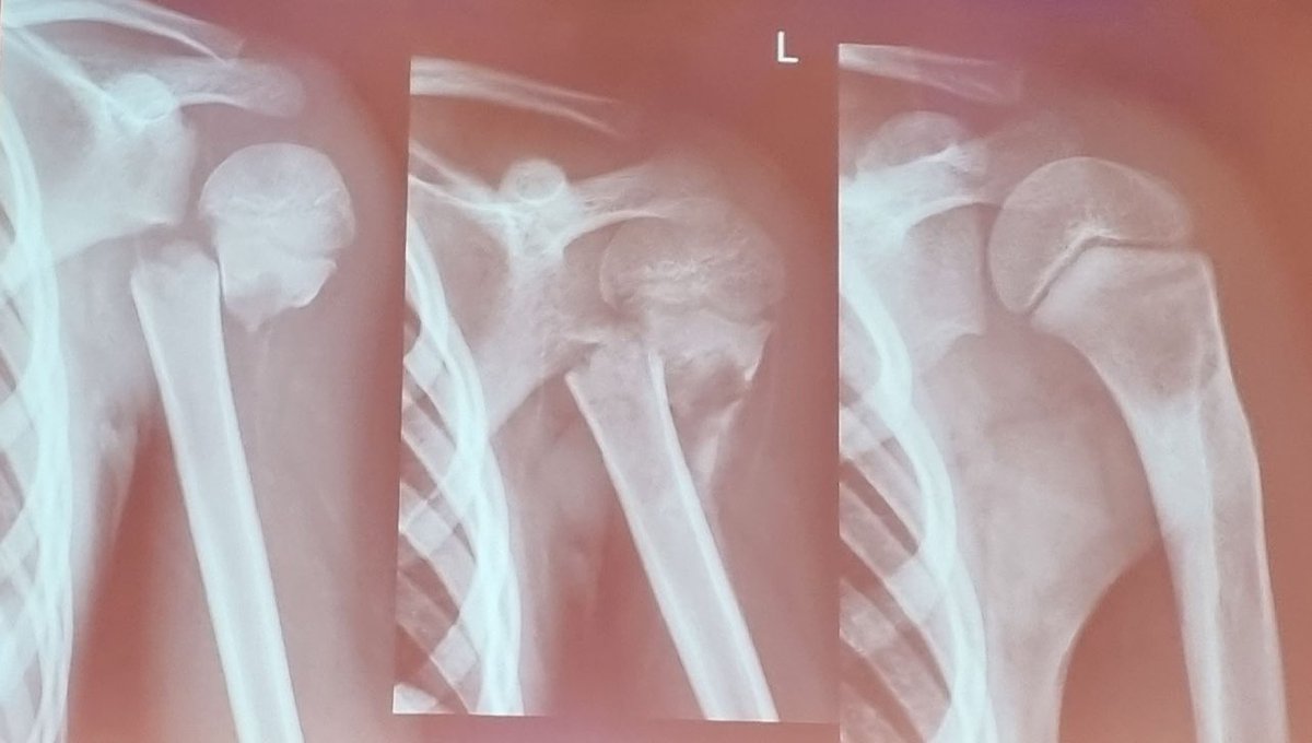 MoAImam's tweet image. They heal.