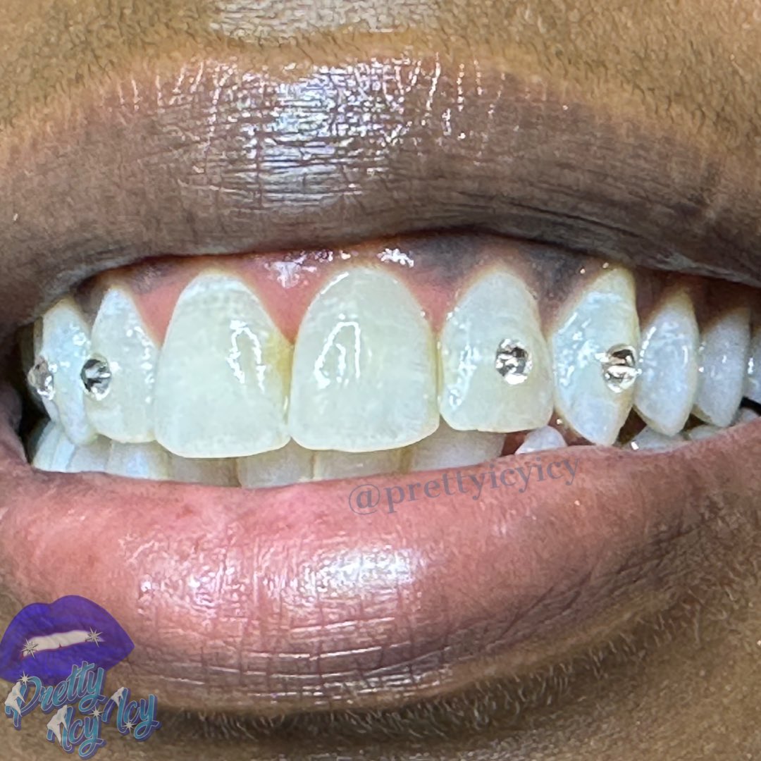 PrettyIcyIcy's tweet photo. #blingbling #teethbling #teeth #teethgems #mo #ks #kansas #missouri #kansascity #kck #kcmo #smile #bling #glitter #preciosacrystals #diamonds #PrettyIcyIcy #TeethWhitening  #toothbling #sparkle #whiteteeth #prettysmile 
#icemeout #blingbling #leessummit #bookme  #toothgems https://t.co/DlxefV4uB5