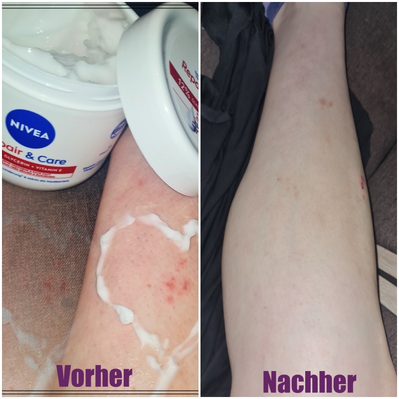 Herzchen Testet (@herzchen_testet) on Twitter photo ··· ฬERBUNG ︙PRODUKTTEST ··· NIVEA REPAIR & CARE - INTENSIVE PFLEGE (TIEGEL)
<a href="/nivea_germany/">NIVEA Deutschland</a> <a href="/Beiersdorf_AG/">Beiersdorf AG</a>
Ob die Intensive Pflege von Nivea meine Haut Verbessert hat? Lest selbst:
herzchentestet.blogspot.com/2023/06/report…
#beauty #skincareroutine ··· ฬERBUNG ︙PRODUKTTEST ··· NIVEA REPAIR & CARE - INTENSIVE PFLEGE (TIEGEL)
<a href="/nivea_germany/">NIVEA Deutschland</a> <a href="/Beiersdorf_AG/">Beiersdorf AG</a>
Ob die Intensive Pflege von Nivea meine Haut Verbessert hat? Lest selbst:
herzchentestet.blogspot.com/2023/06/report…
#beauty #skincareroutine