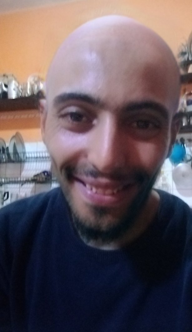 يقولون بأن الرجل الناجح يستمد نجاحه من صلعته 🧐🤣
#سعيدالجمالي #الرجل_الأصلع 
.
لا تنزل
.
.
واراسك شحال قاصح
.
.
باين بلي راك مغربي
.
.
خدمت الصورة بسنابشات صافي تهنيتي 😒

هذا واحد أصلع قال ليه صاحبو علاش نتا ديما اصلع رد عليه الزمان، قال اوا صافي هاد المرة متبقاش تحسن عندو😂🤣