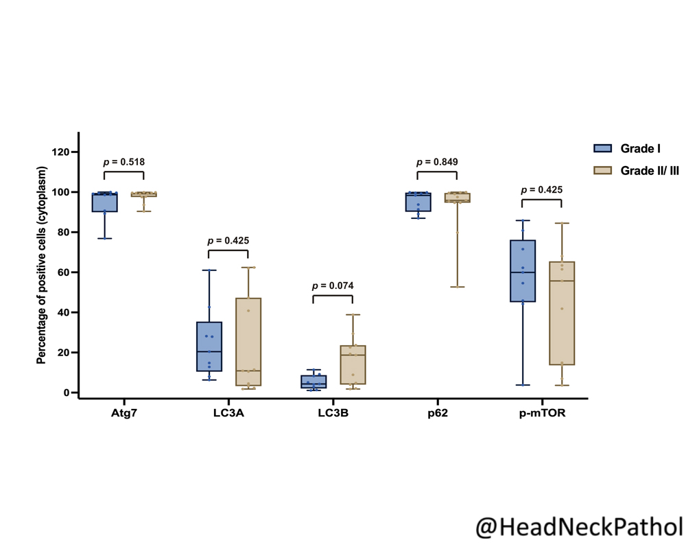 Immunoexpression of Autophagy-Related Proteins in Salivary Gland Tumors: An Exploratory Study Pires, Ferreira, Cavalcante, et. al. rdcu.be/dcO2v #HeadNeckPathol #HNPJ #HeadandNeckPath #Pathology #ENTPath #PathologyTweet