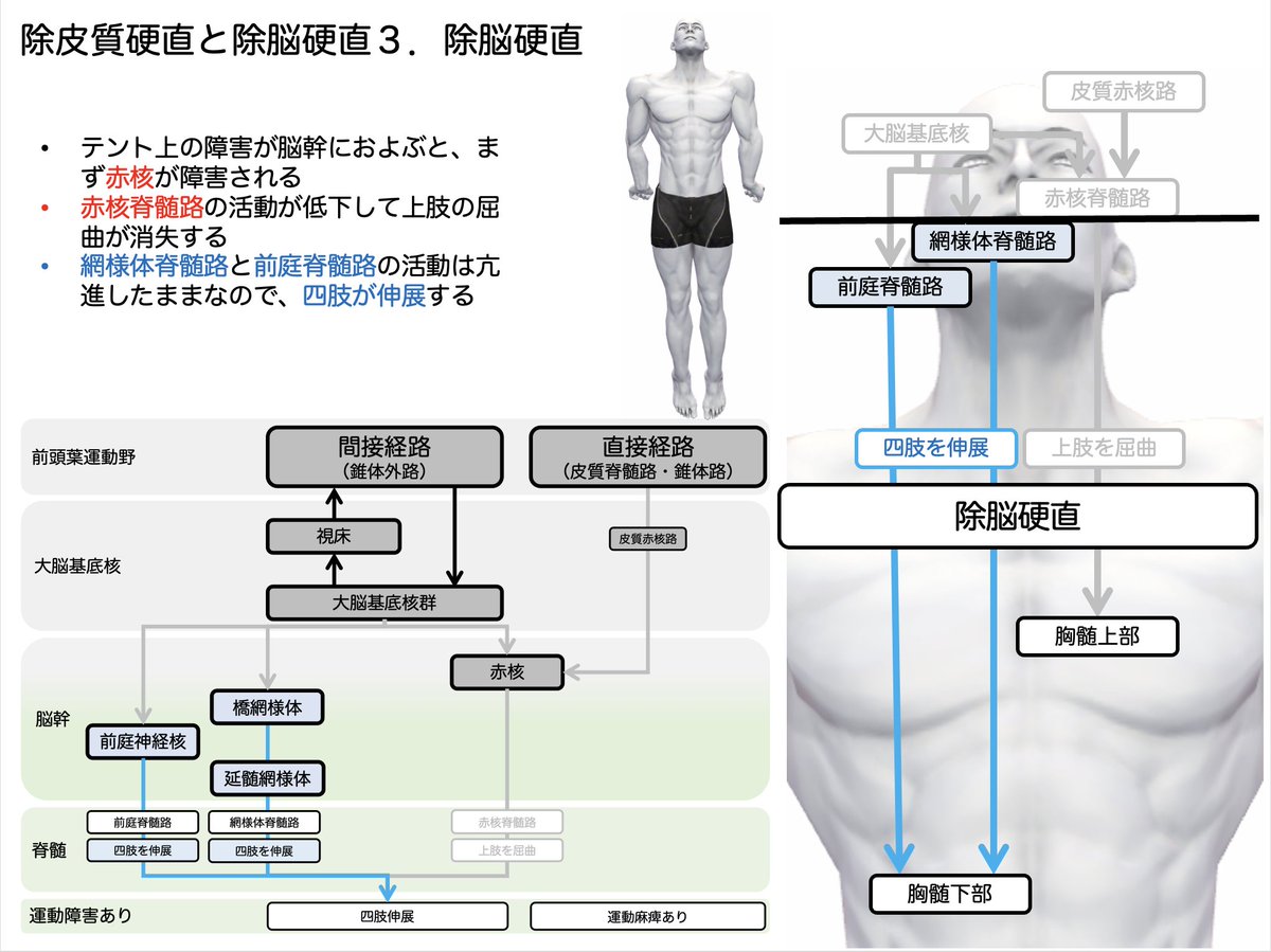 除皮質硬直姿勢 – 除皮質硬直 ポジショニング – PJCJZY