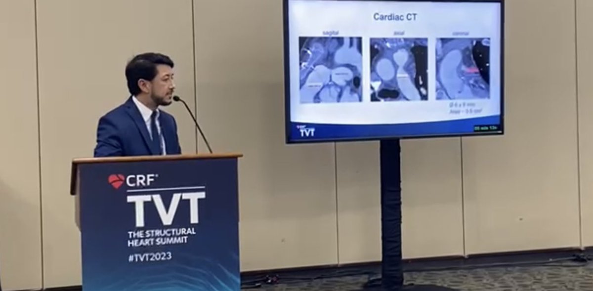 will_go's tweet photo. I’m very honored and happy for having the opportunity to participate in TVT2023! Looking forward to the next conference already! #TVT2023 #sbhci #structuralheartdisease https://t.co/PEdHi0iKVi