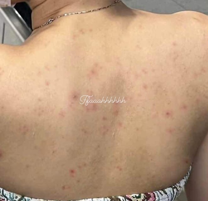 nnadddd19's tweet photo. I nak share sabun yg boleh merawat masalah jerawat yang selalu banyak dekat bahagian belakang badan.

Btw ada sabun buku dengan sabun liquid, boleh la pilih kesesuaian korg yg Selesa nak pakai. 
Yg bestnya memang bagus sangat untuk melawan &amp; merawat jerawat.

(Cont) https://t.co/z4URLYZWkE