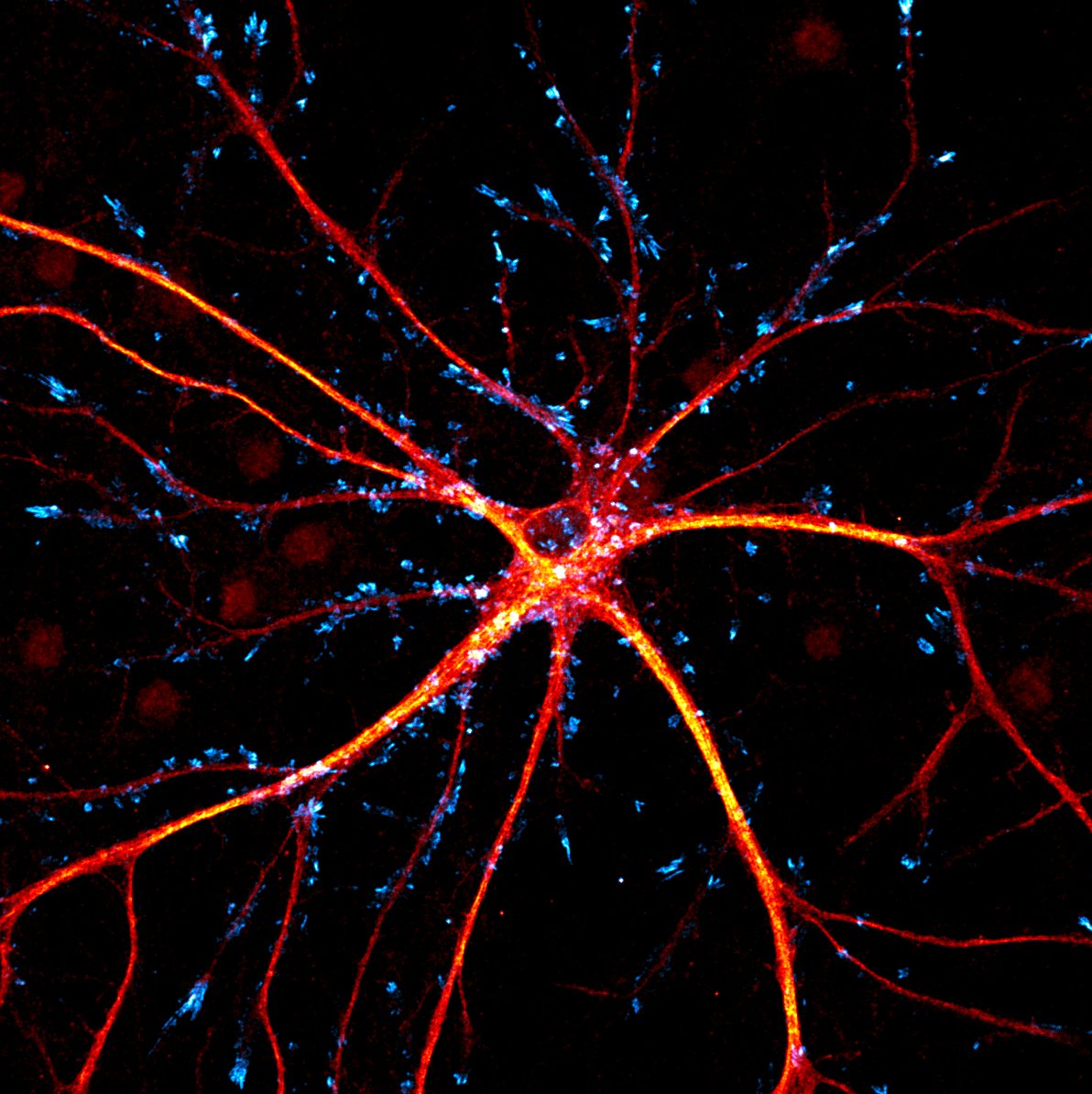 It's been a long night of analysis, but these astrocytes keep me motivated!