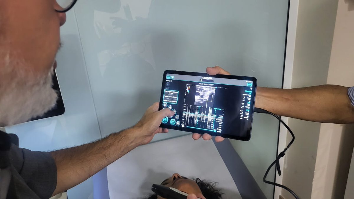 See how SonoEye empowers the doctor to scan the carotid artery with ease. For different #𝐏𝐎𝐂 𝐚𝐩𝐩𝐥𝐢𝐜𝐚𝐭𝐢𝐨𝐧𝐬, its 𝐩𝐨𝐫𝐭𝐚𝐛𝐢𝐥𝐢𝐭𝐲 and 𝐬𝐰𝐢𝐟𝐭 𝐬𝐜𝐚𝐧𝐧𝐢𝐧𝐠 capabilities make it your top choice. 
Learn more at chisonsonoeye.com

#ultrasoundimaging