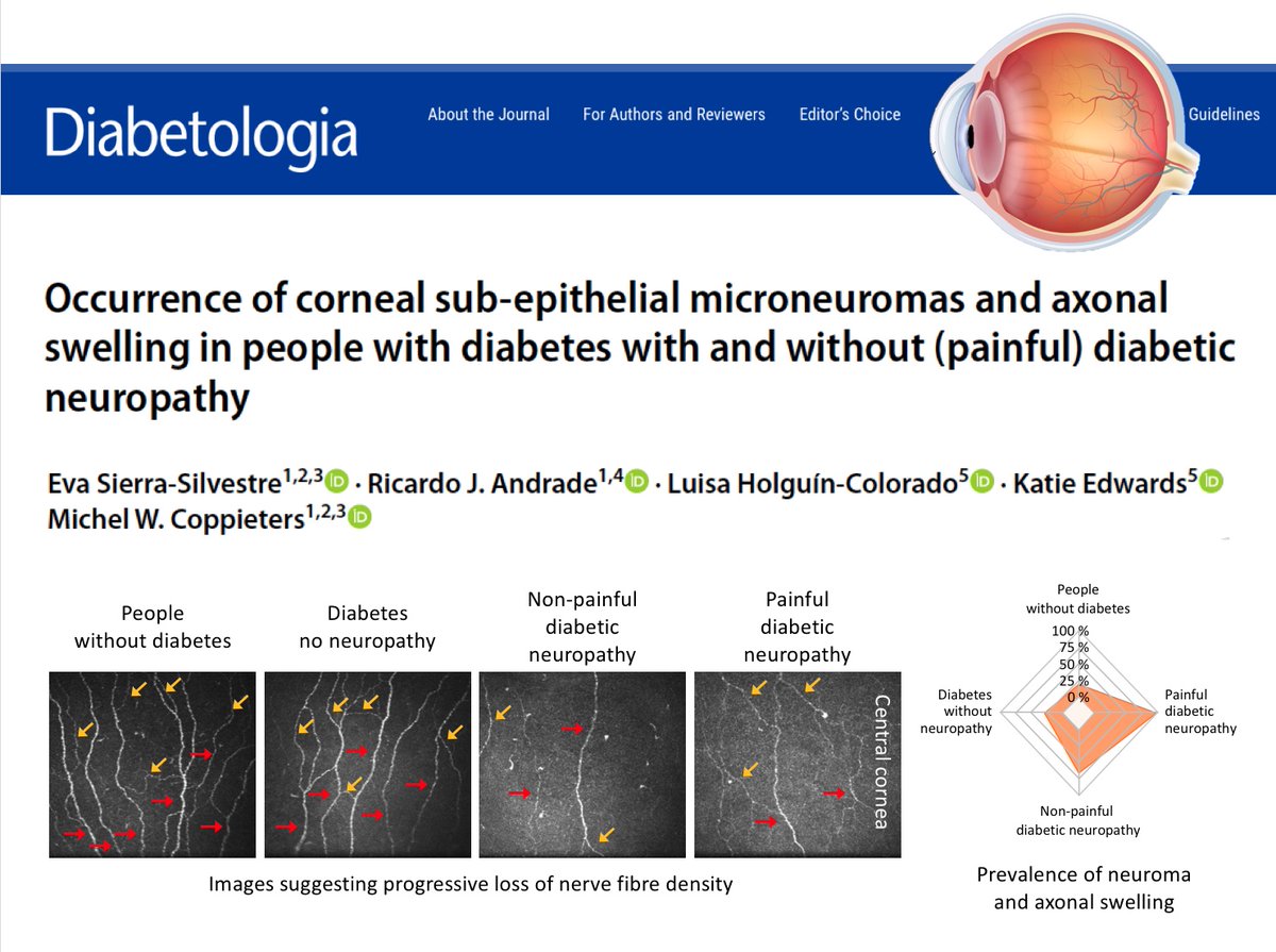 michelcoppie's tweet photo. Can nerves in the eye tell something about the pathophysiology of diabetic neuropathy in general? Open access @SpringerNature in @DiabetologiaJnl: https://t.co/oZsKXXGEfB Congrats @esiesil for another impressive PhD paper.
@Griffith_Uni @MenziesHealth @hopkins_centre @VU_FGB @QUT https://t.co/l1YF0sg0RZ