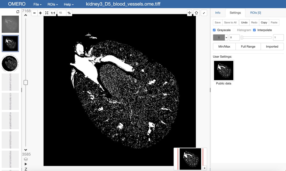 IDR News (@idrnews) on Twitter photo IDR releases a new study ahead of its publication - Terabyte-scale supervised 3D training and benchmarking dataset of the mouse kidney by Kuo, <a href="/VKurtcuoglu/">Vartan Kurtcuoglu</a> et al.
idr.openmicroscopy.org/search/?query=… IDR releases a new study ahead of its publication - Terabyte-scale supervised 3D training and benchmarking dataset of the mouse kidney by Kuo, <a href="/VKurtcuoglu/">Vartan Kurtcuoglu</a> et al.
idr.openmicroscopy.org/search/?query=…