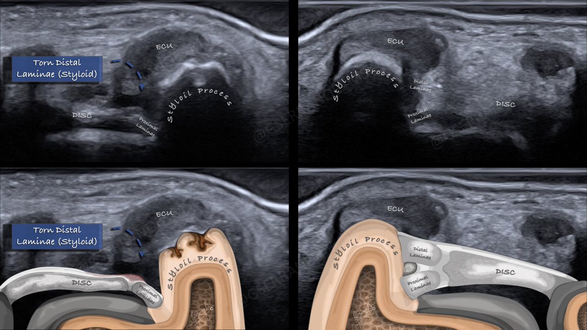 Gonzalo Serrano-Belmar. tweet media
