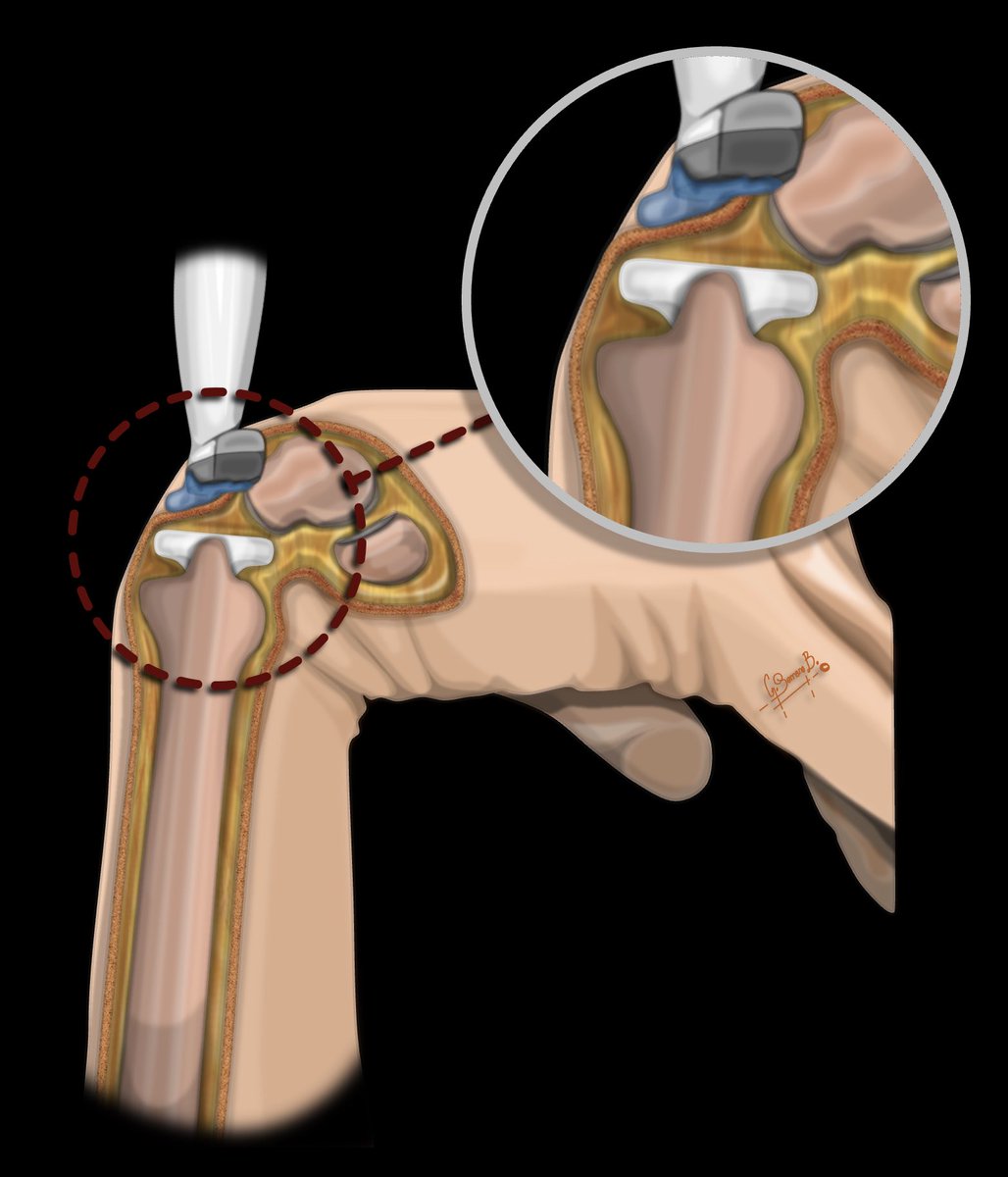 Gonzalo Serrano-Belmar. tweet media