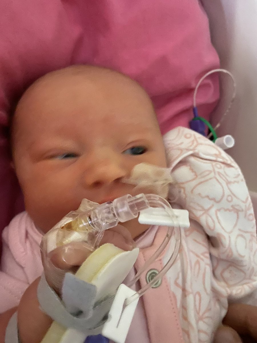 I couldn’t even stand by my baby’s side when she was born with my fiancé because of covid restrictions. I wasn’t there when she was told our daughter had a rare brain abnormality.  The impact is enormous. So should the consequences now to people who have lied  #ukgoverment #tory