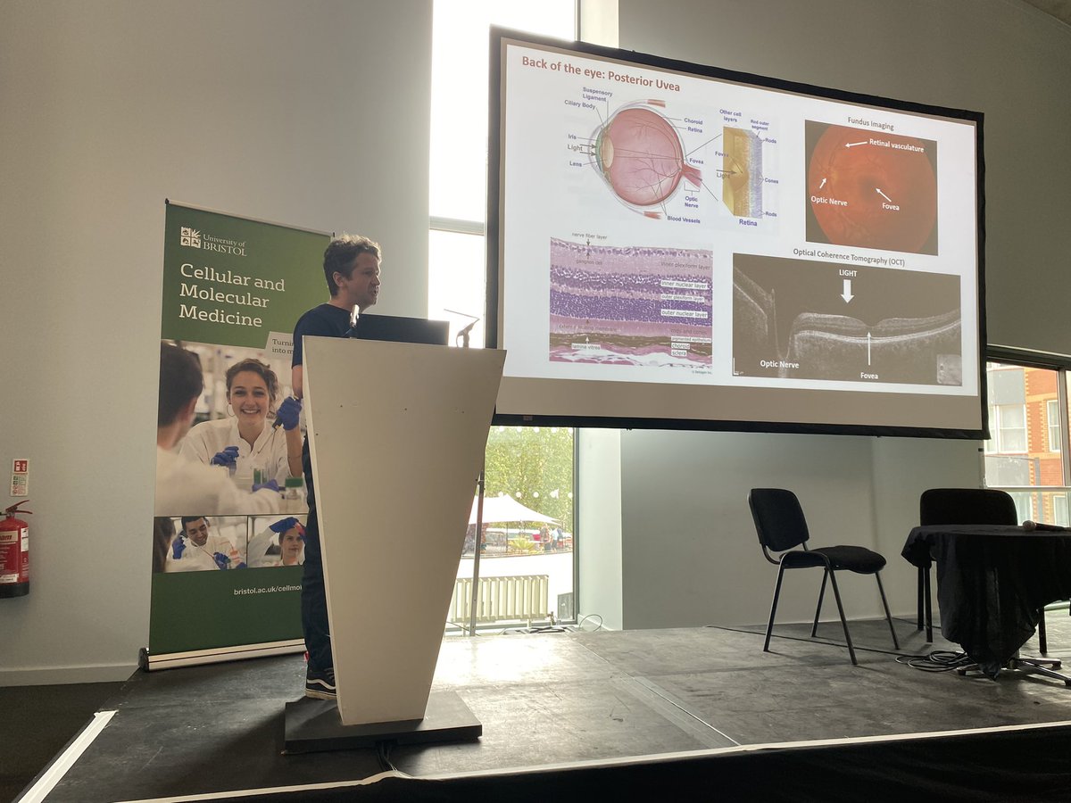‘Autoimmunity, Inflammation and Immune Privilege’ session: excellent talks from Lucy Walker, David Wraith, Ben Jenkins and Dave Copland.  From ocular autoimmunity to 🎯 costimulation, immunometabolism, and antigen-specific cells in autoimmunity👌#BSIBristol23 #CMMBristol