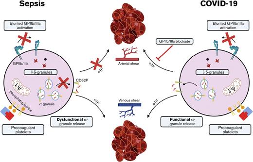 Blunted GPIIb/IIIa activation is uncoupled from functional α-granule release in patients with COVID-19, differing from bacterial sepsis. loom.ly/hshdP-E #thrombosisandhemostasis #plateletsandthrombopoiesis