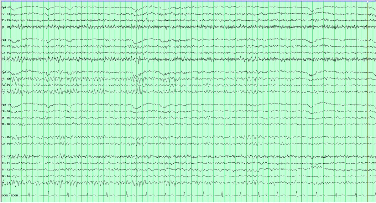 Rebecca E. Matthews, MD tweet media