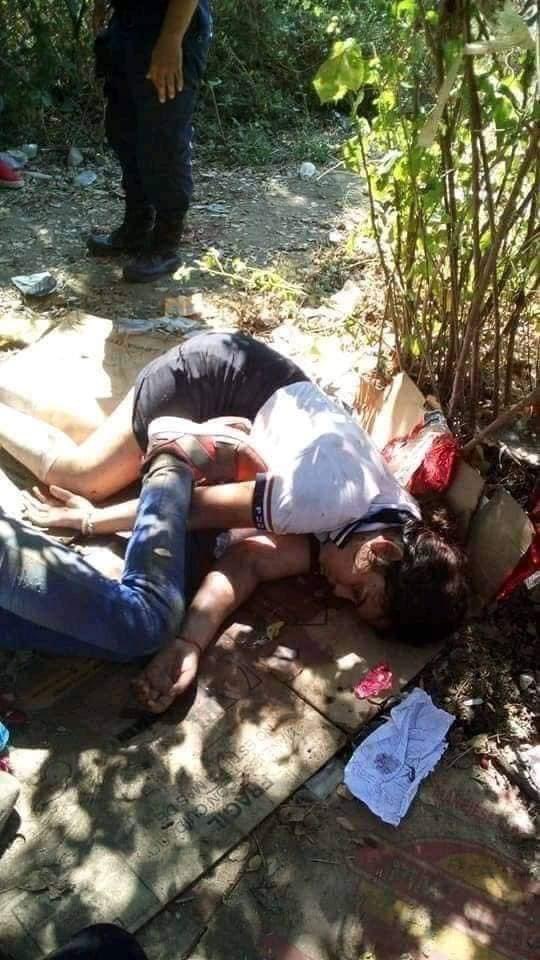 JC_Shitposting's tweet photo. Terribles imágenes de los 2 jóvenes que fueron atacados por 2 osos. 

Tengan mucho cuidado y cuiden a sus hijos. https://t.co/dtraRNyTZa