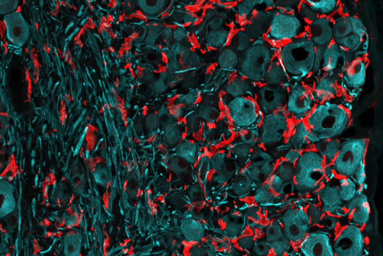 WashUMedNeuro's tweet photo. Multiple positions open in Valeria Cavalli's Lab! 
🔬Senior scientist
🧠Postdoc
🐁Senior research technician
Join this all-star team in their investigations into neural regeneration: https://t.co/dwWOZ7MawJ
#postdocposition #phdlife #neurotwitter #stemjob https://t.co/vRI3kAGnke