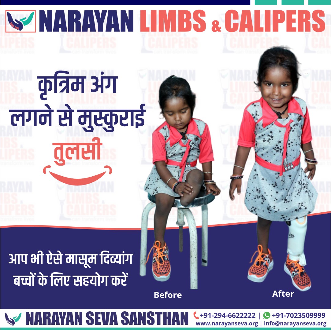 narayanseva_'s tweet photo. अंग ना होने की वजह से दिव्यांग बच्चों को अपने बचपन और आने वाले जीवन में कई तरह से परेशानियां झेलनी पड़ सकती है परन्तु एक कृत्रिम अंग उनकी परेशानियों का निवारण कर सकता है तो आइये तुलसी जैसे और भी बच्चों को कृत्रिम अंग लगाएं।
https://t.co/9SyAnTvxcF
#narayanlimb #artificiallimb https://t.co/S4h1n3Lh9b