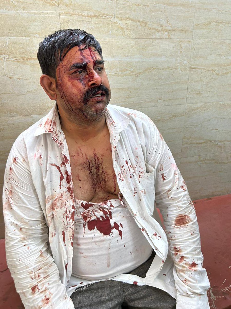 ये ग्रेटर नोएडा के सूरजपुर कसबे में रहने वाले विपिन शर्मा हैं। इनका यह हाल गली के गुंडों ने किया है, क्योंकि इन्होंने कार निकालने के लिए रास्ता मांगने की हिमाकत की।
<a href="/noidapolice/">POLICE COMMISSIONERATE GAUTAM BUDDH NAGAR</a> 15 दिनों से हमलावरों को तलाश नहीं कर पाई। वैसे बक़ौल पुलिस, दिन-रात कोशिश जारी है। <a href="/Uppolice/">UP POLICE</a> <a href="/CP_Noida/">CP Noida</a>